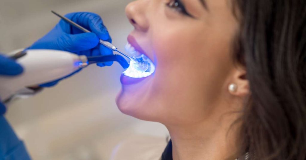 replace old cosmetic fillings