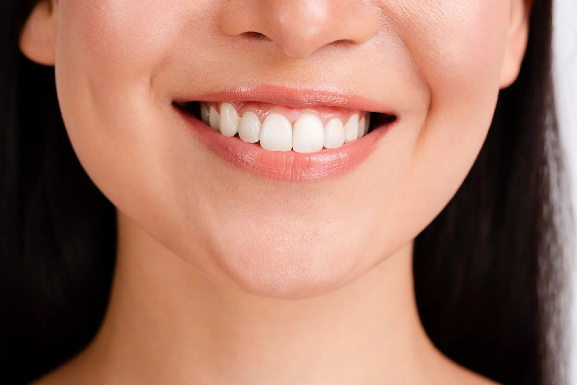 Smile Makeovers Jacksonville, FL