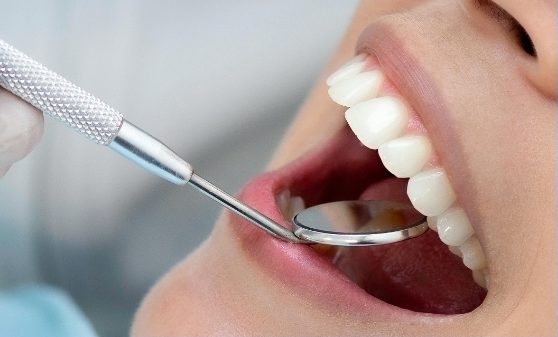 Dental-Cleaning-and-Exam.jpg