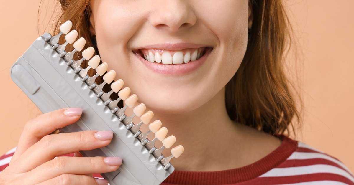 composite veneers aftercare​