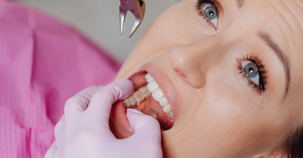 Back Tooth Chipped with Filling