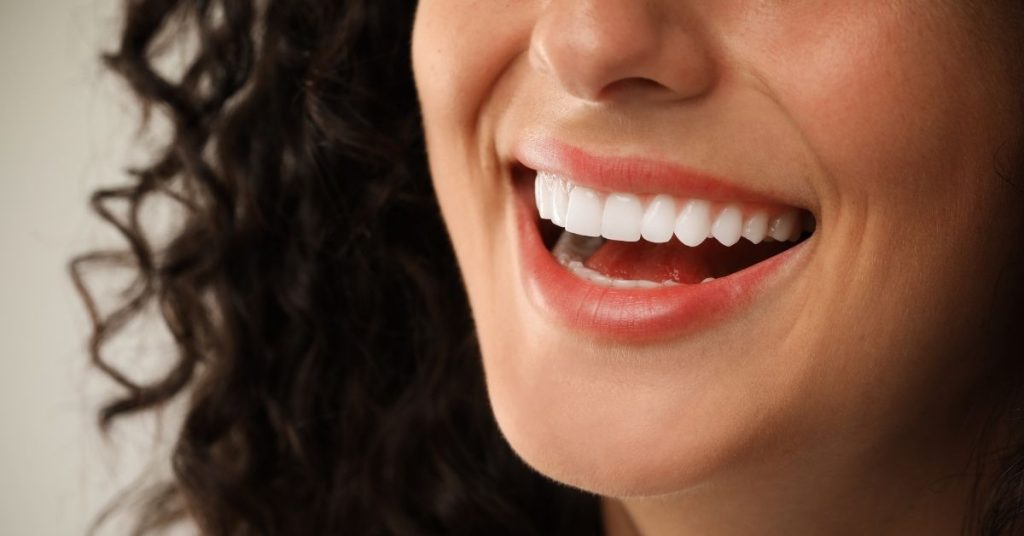cost of porcelain veneers​ in Jacksonville