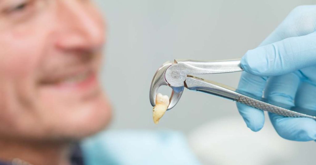 Tooth Extraction Aftercare: Do's, Don'ts & Recovery - Your Digital Dentist Tooth Extraction Aftercare